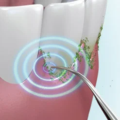 Salle De Bain Et Hygiène|Tempsl Détartreur ultrasons